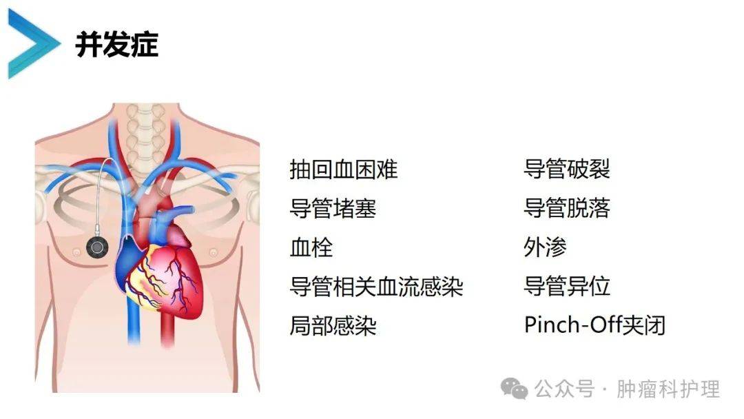 输液港适应症图片