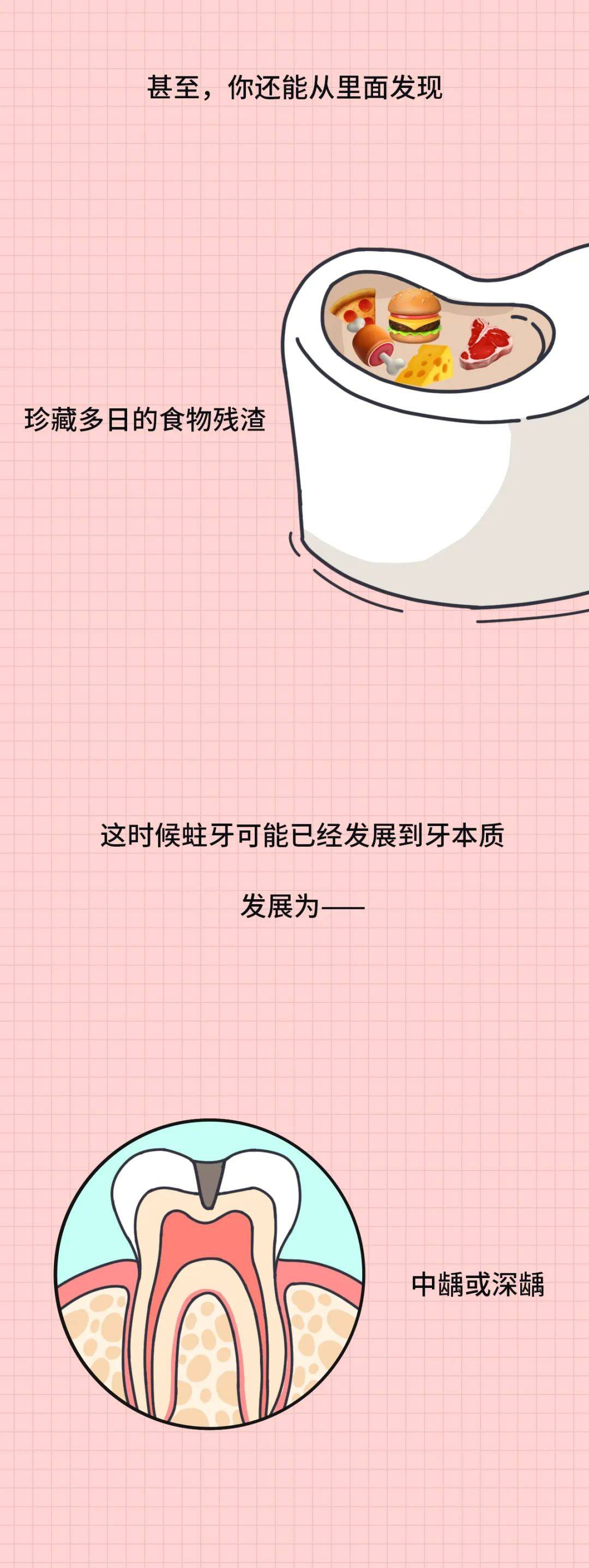 大部分人都有的口腔问题越早治疗越省钱