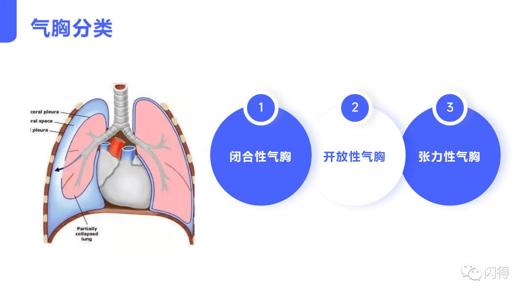 开放性气胸图片图片