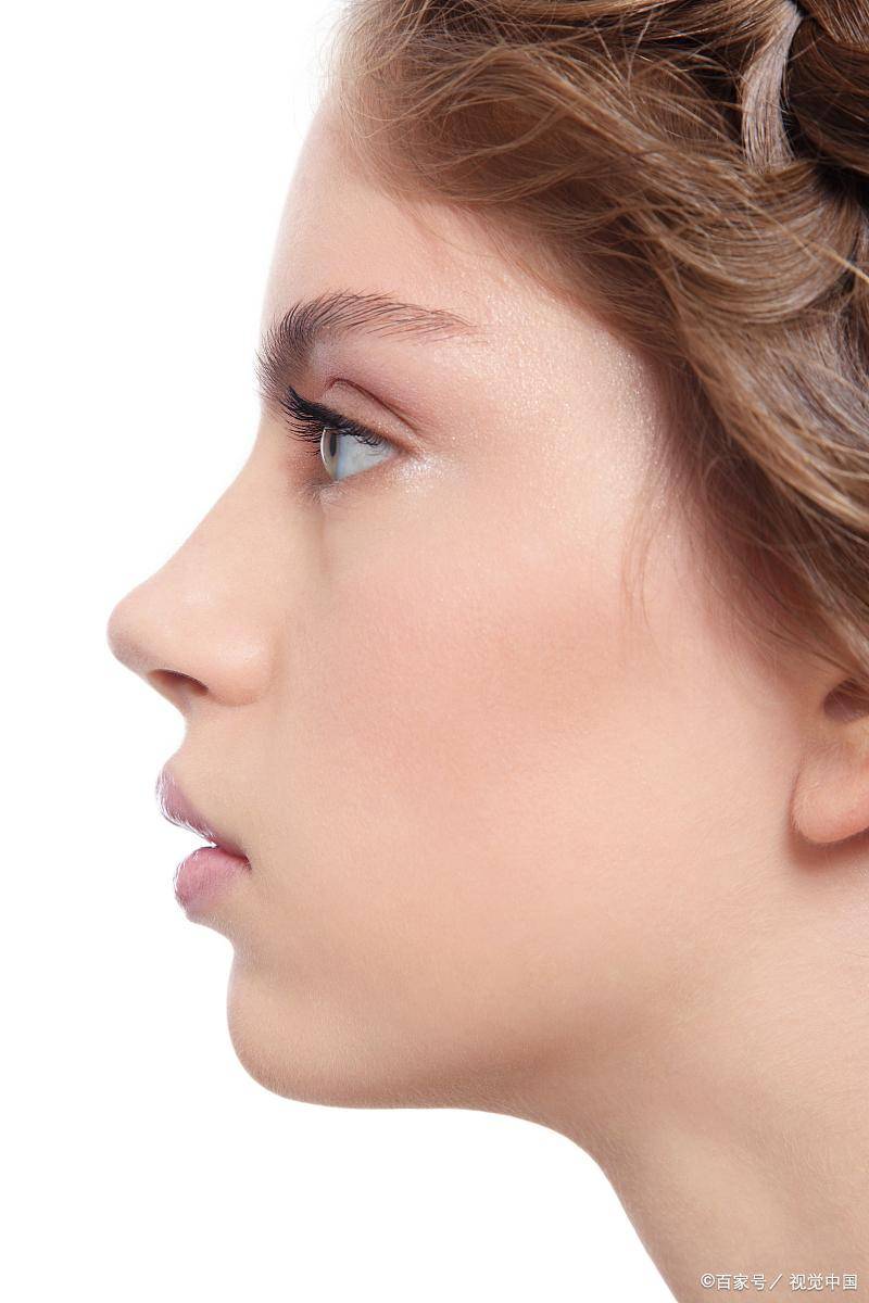 鼻基底充填:重塑完美鼻型,提升面部整体美感