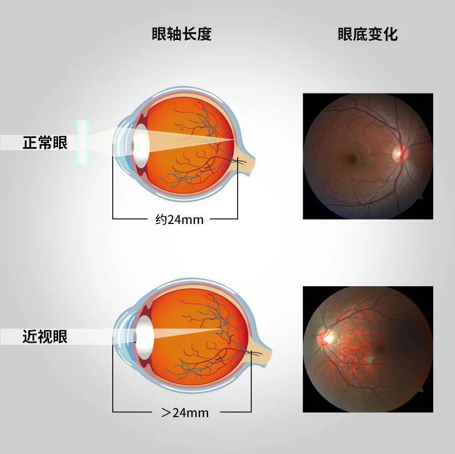 眼睛看物体变形图片