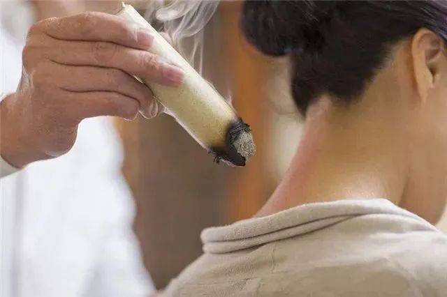 横纹叫脑梗纹,竖纹叫心梗纹.遇到这样的脑袋,一定要及时疏通!