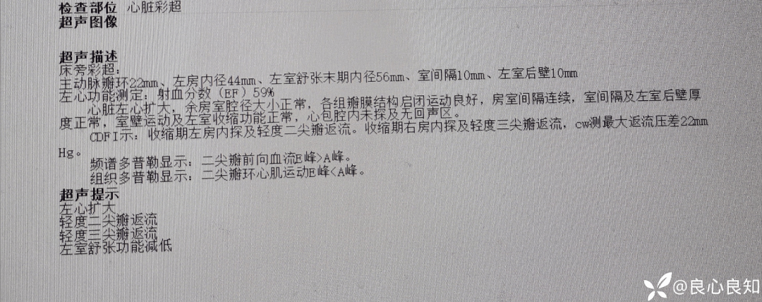 上面不停出血下面心脏梗了止血抗凝怎么选