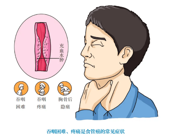 肿瘤防治宣传周 