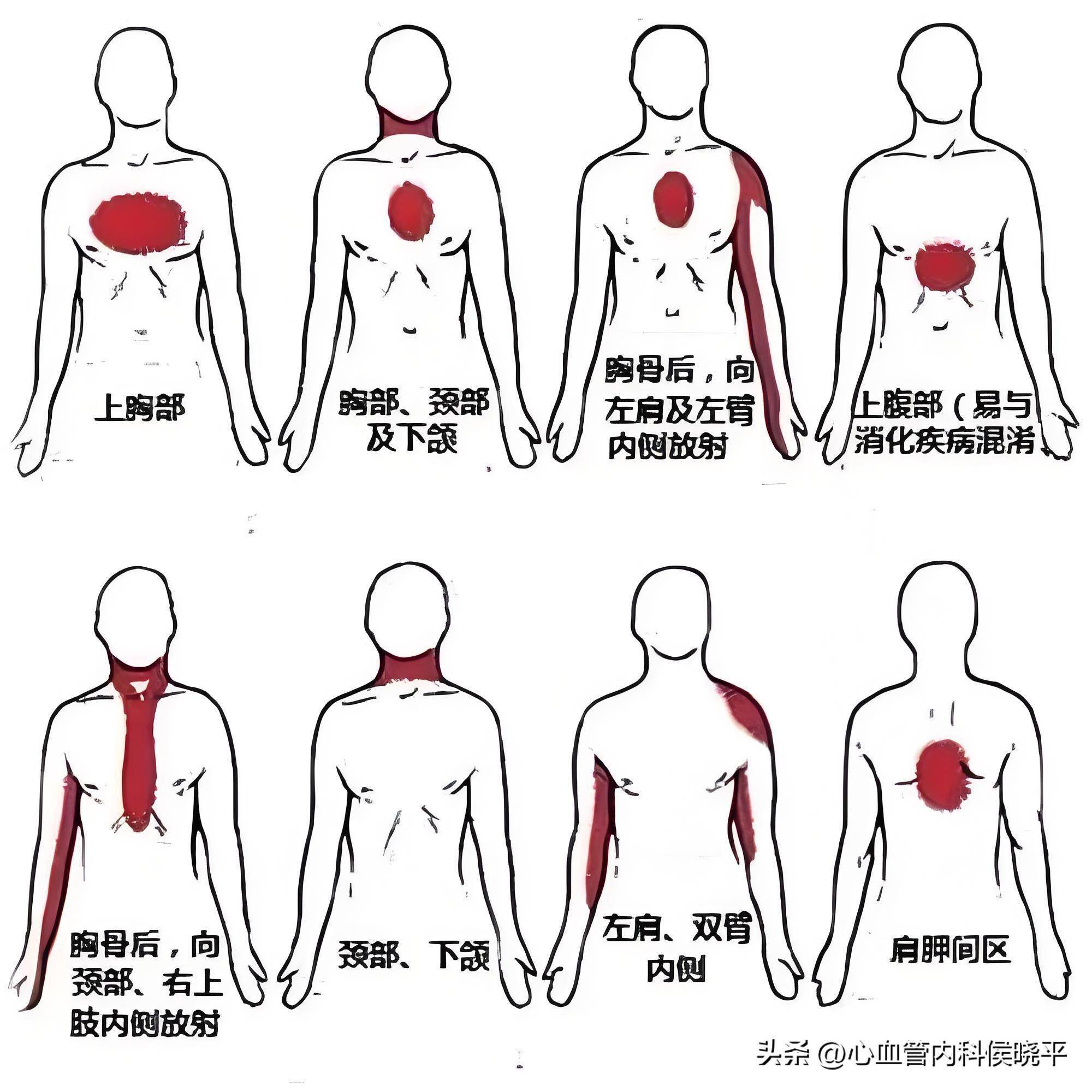 心脏疼痛的正确位置图图片