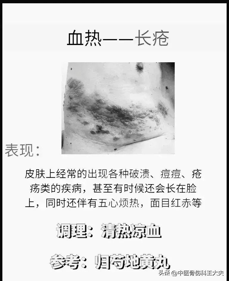 血热,血寒,血虚,血瘀,身体会有哪些表现?