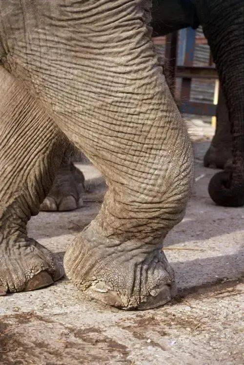 “象腿”，“又硬又粗”！怎么破？在线等