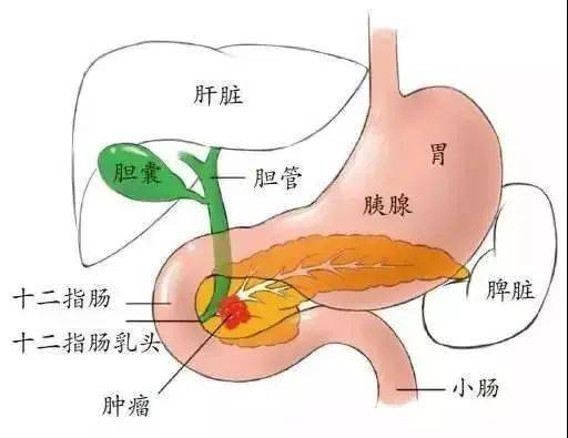 胆胰壶腹图片