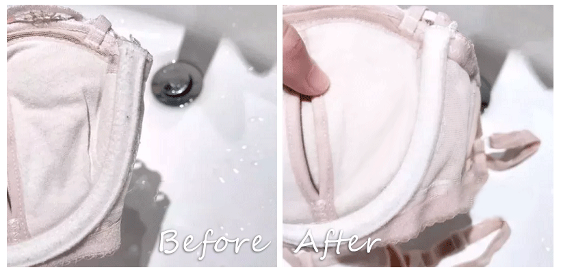 23岁女子患外阴癌前病变,罪魁祸首为所有女性敲响警钟