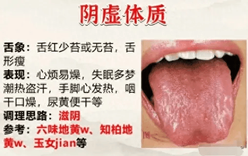 不同体质的舌苔都有什么特点？中医教你看舌识别体质及用药