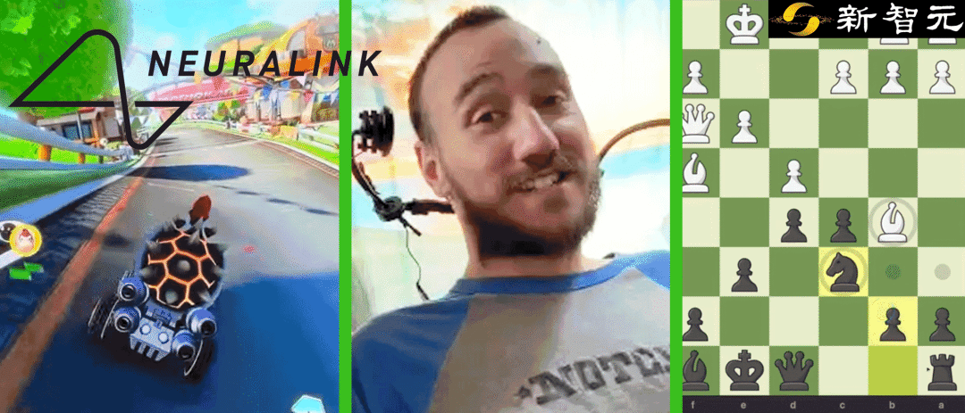 开脑100天,马斯克首位脑机接口患者出故障?