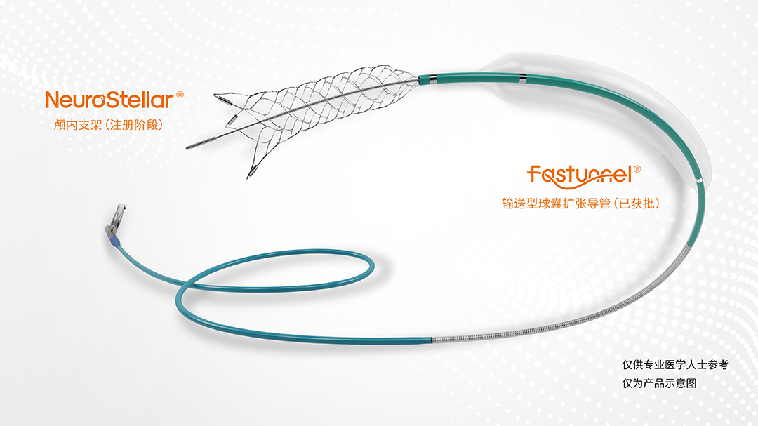 宁敬致远 卓伟之技|李敬伟教授团队:fastunnel输送型球囊扩张导管治疗