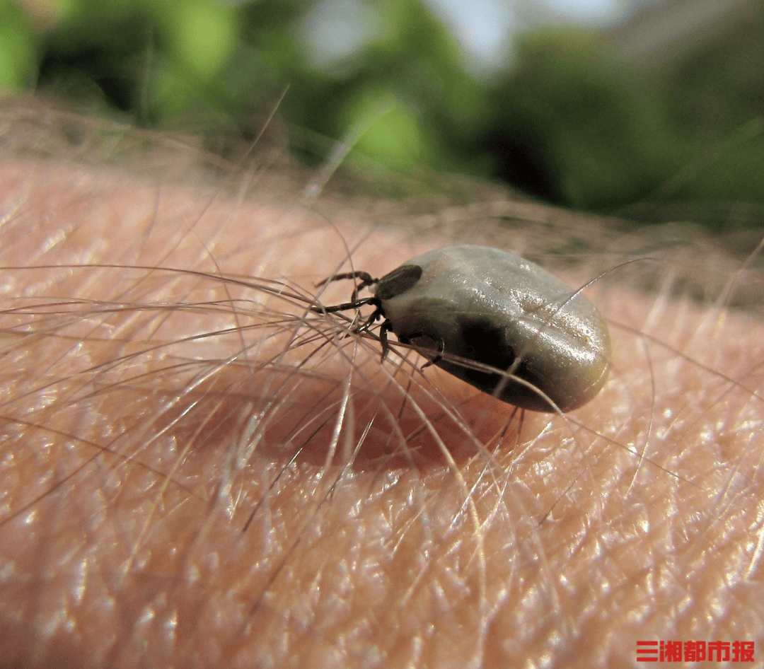 近日,有网友在社交平台上发帖,记录了母亲从被蜱虫咬,到发病去世的全