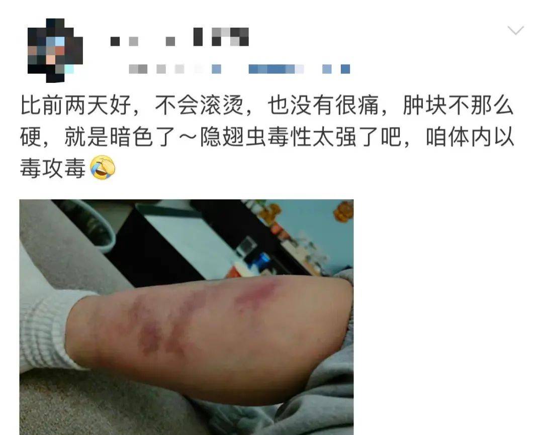 很多人曾中招,深圳也有……_皮肤_虫子_刘先生