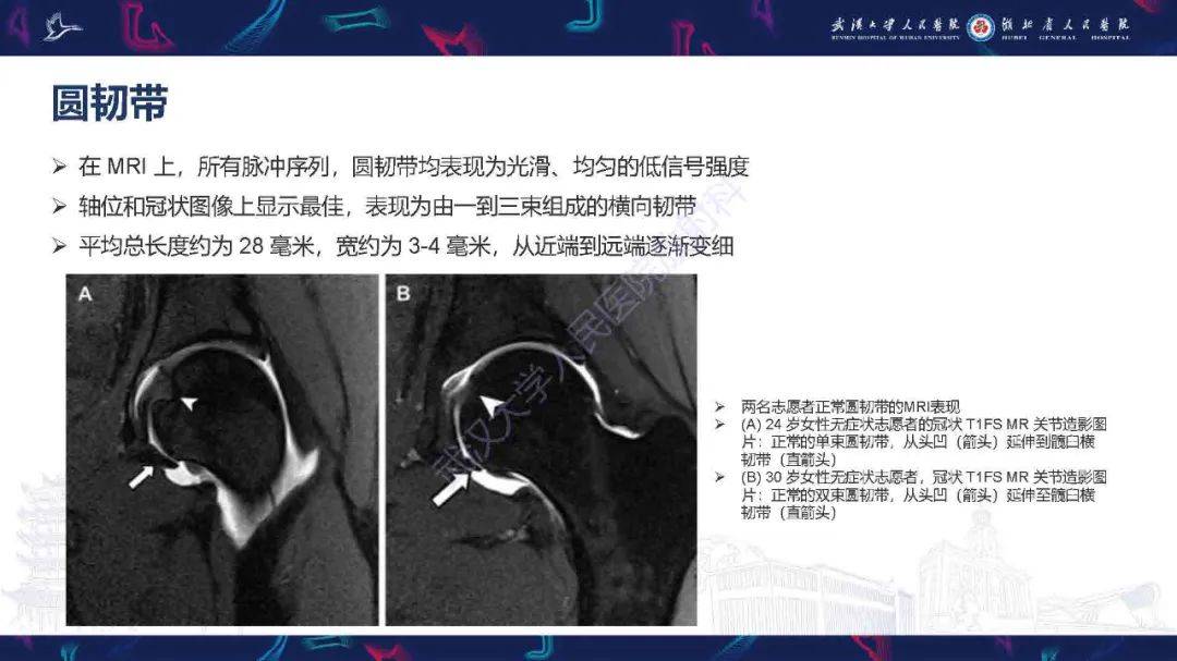 髋关节盂唇解剖图图片