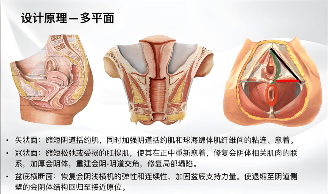 助力性福,让爱"0"距离——3d生物束带修复术,拯救你的产后"松,垮,掉"