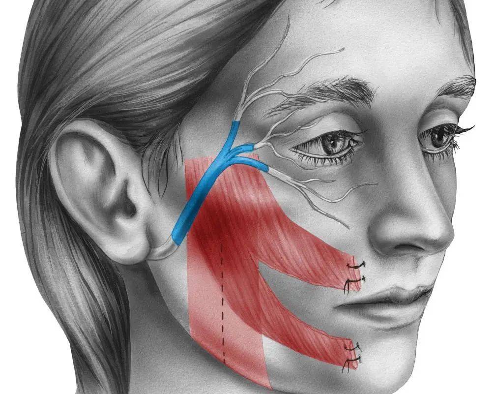 罪魁祸首竟是→_面神经_原因_压迫