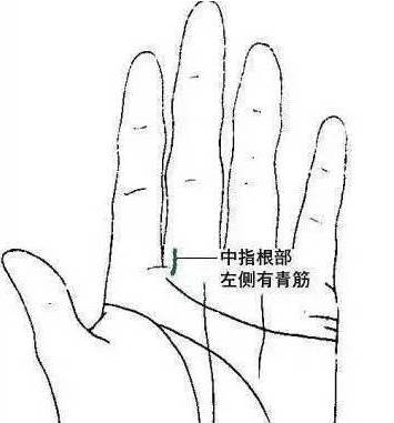 【原来】这里有青筋,当心脑血管!