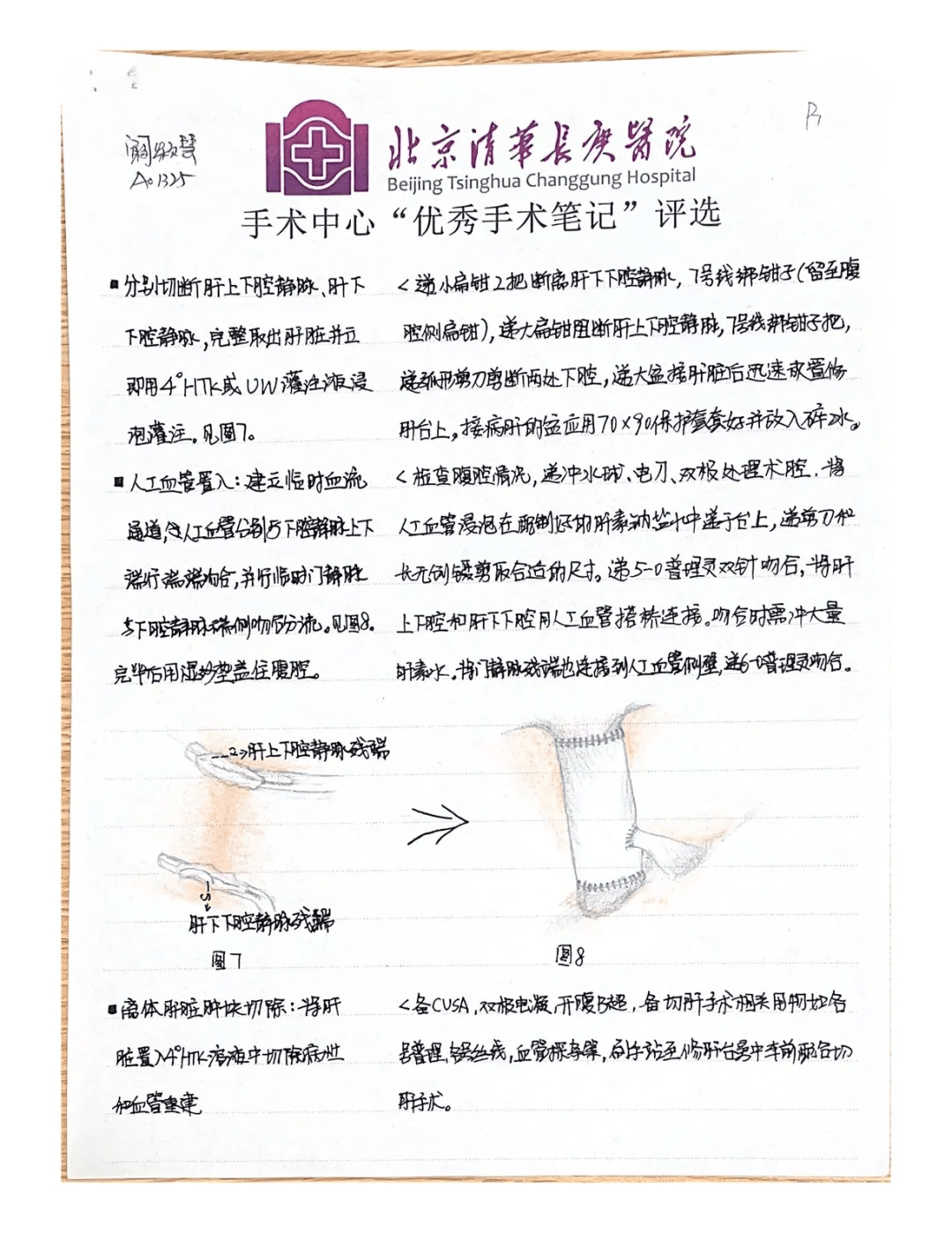 分享一份让护理部都为之颤抖的手术护理笔记