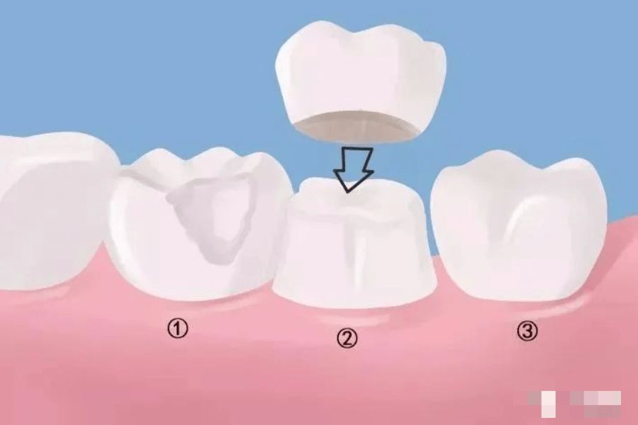 牙本质是硬的还是软的图片