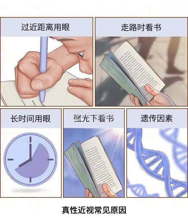 【爱眼护眼系列宣传】为什么会得近视?_眼睛_影响因素_父母