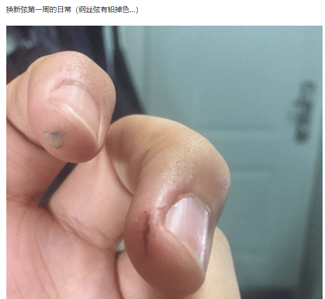 学乐器人的手,惨不忍睹到什么地步?