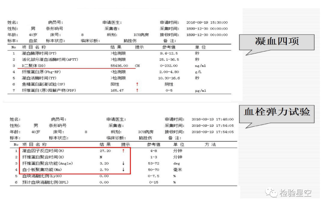 血栓弹力图检验报告图片