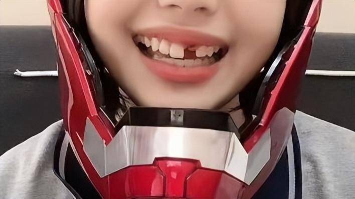 之后,女网红也是直接开启了新赛道,不仅不补上自己的门牙,反而还以此