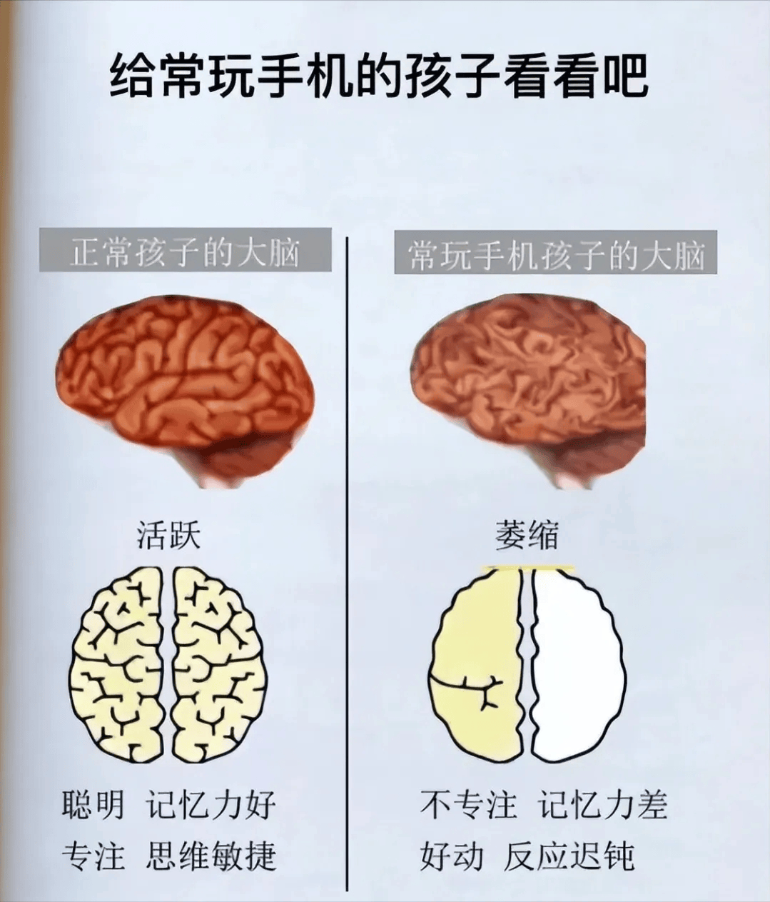 长期刷手机,会削弱大脑神经元之间的连接,减少大脑沟壑的数量,进而