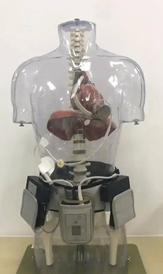 装国产人工心脏的人生8小时充一次电不能坐飞机洗澡得防水