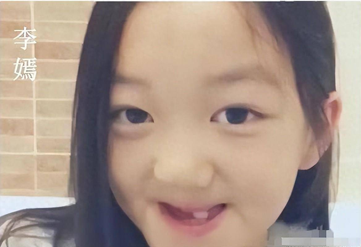 王菲女儿李嫣做第4次"兔唇"修复:照片公开大变样,美得很高级