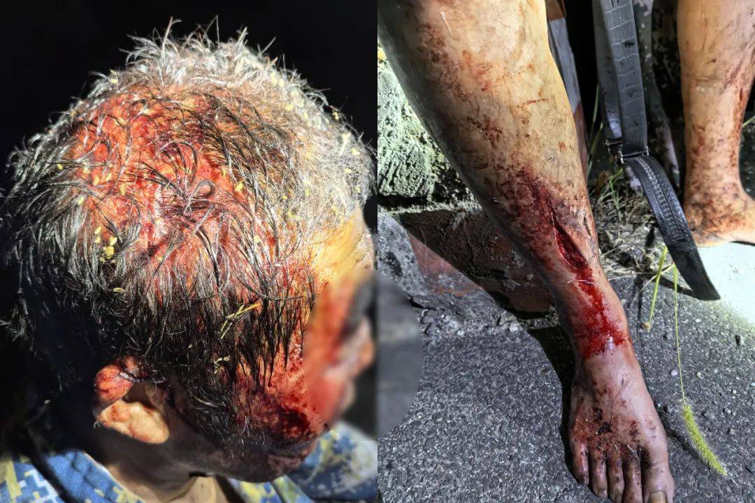 现场照片揪心绍兴一男子深夜连人带车摔下10米高坡