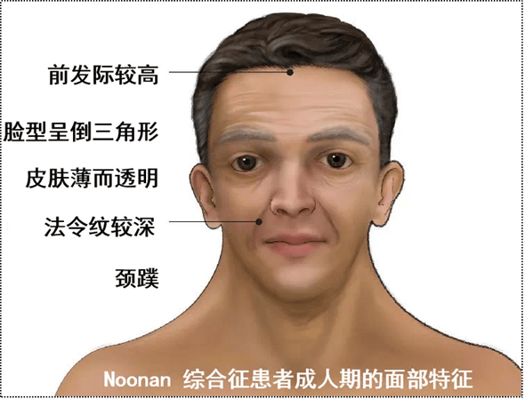 义诊丨"矮"因难寻,为爱呐"罕"