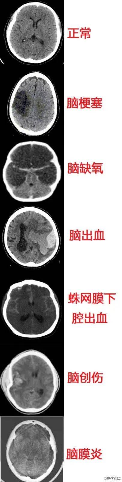 神经系统速记口诀及超全图谱