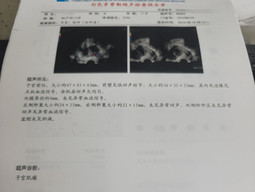 子宫内膜厚诊刮真后悔图片