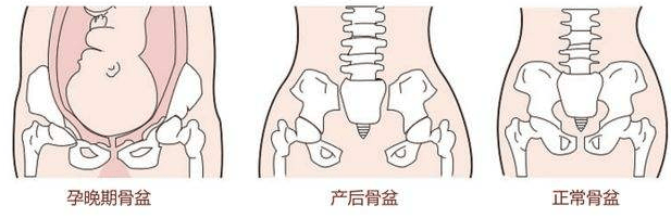 母体骨盆入口斜径图解图片