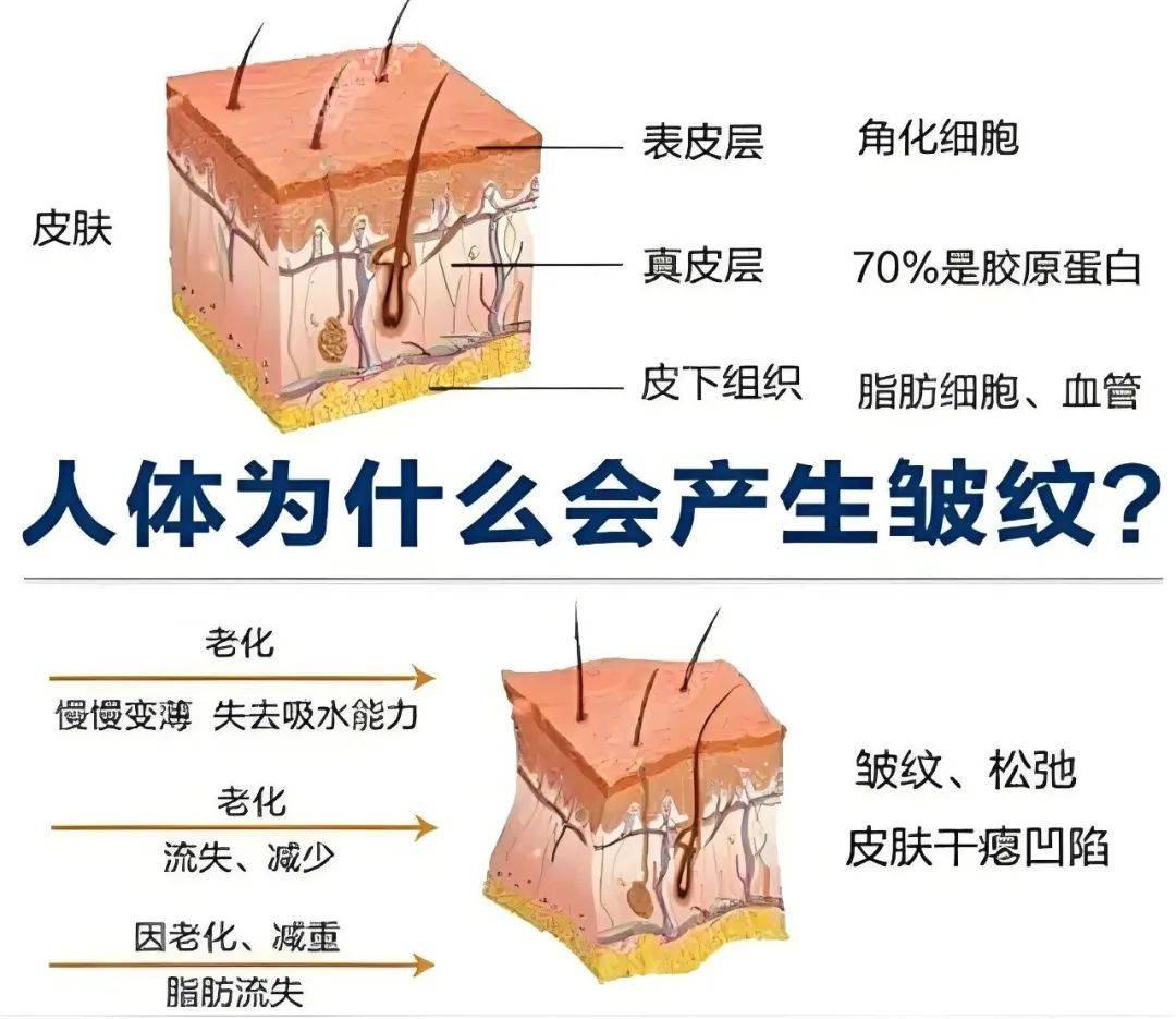 皮肤纹理走向图片