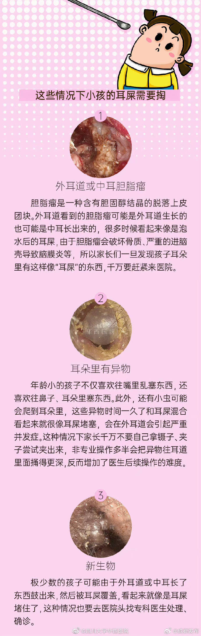 铁耳屎长什么样图片