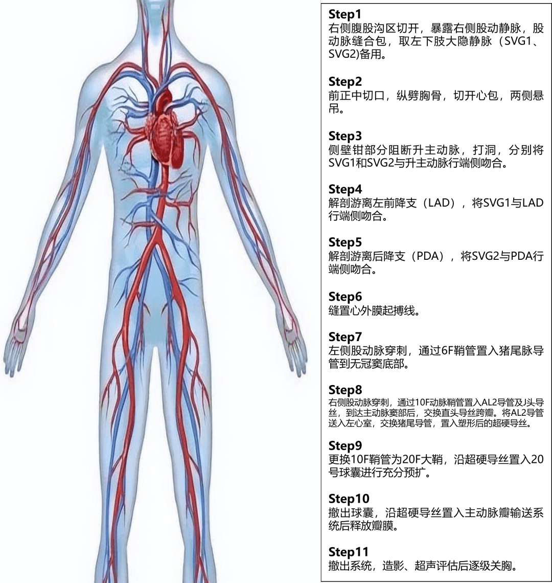 心脏造影图解析图片