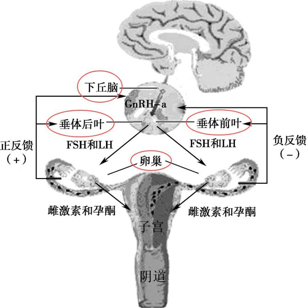 前庭球正常图片