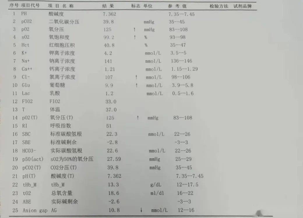 24小时心电图指标解读图片