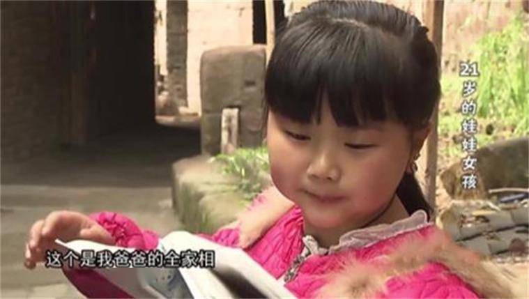 现实版"天山童姥":7岁衰老如老妇,17岁返老还童,现在如何?