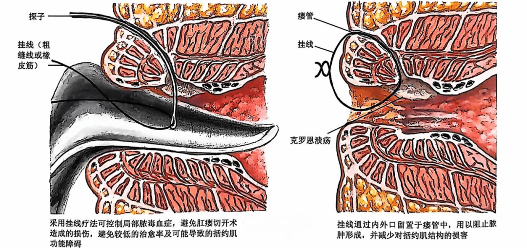 手术解剖专场