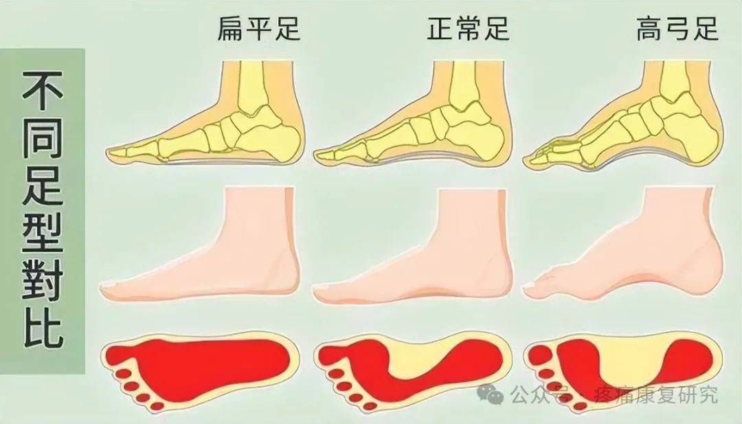 足踝生物力学6s中心图片