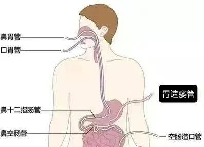 食管有多长图片