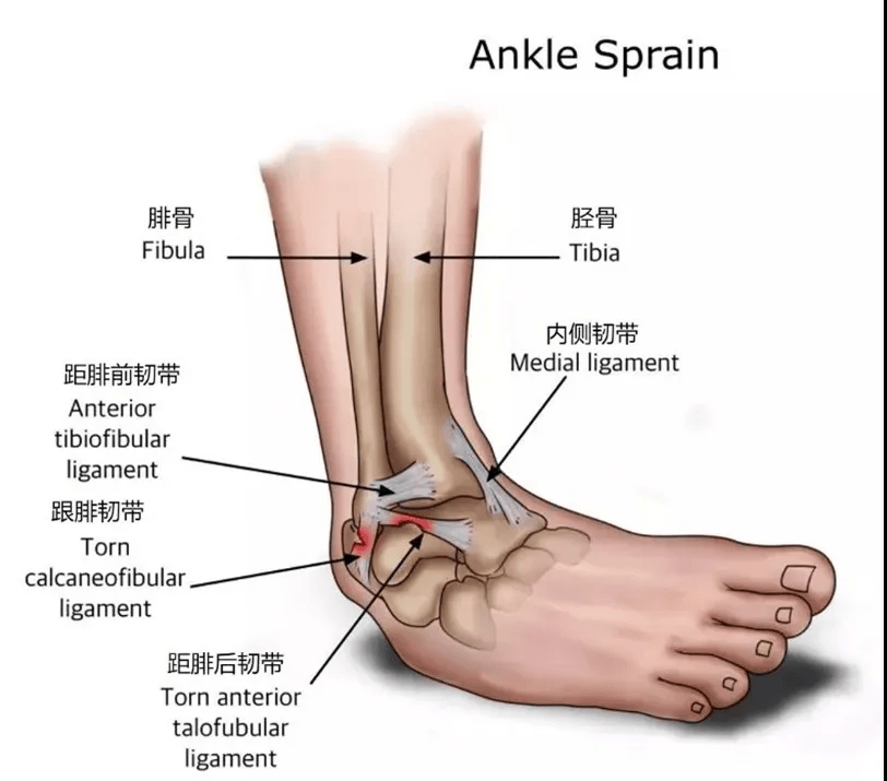 外踝位置图片
