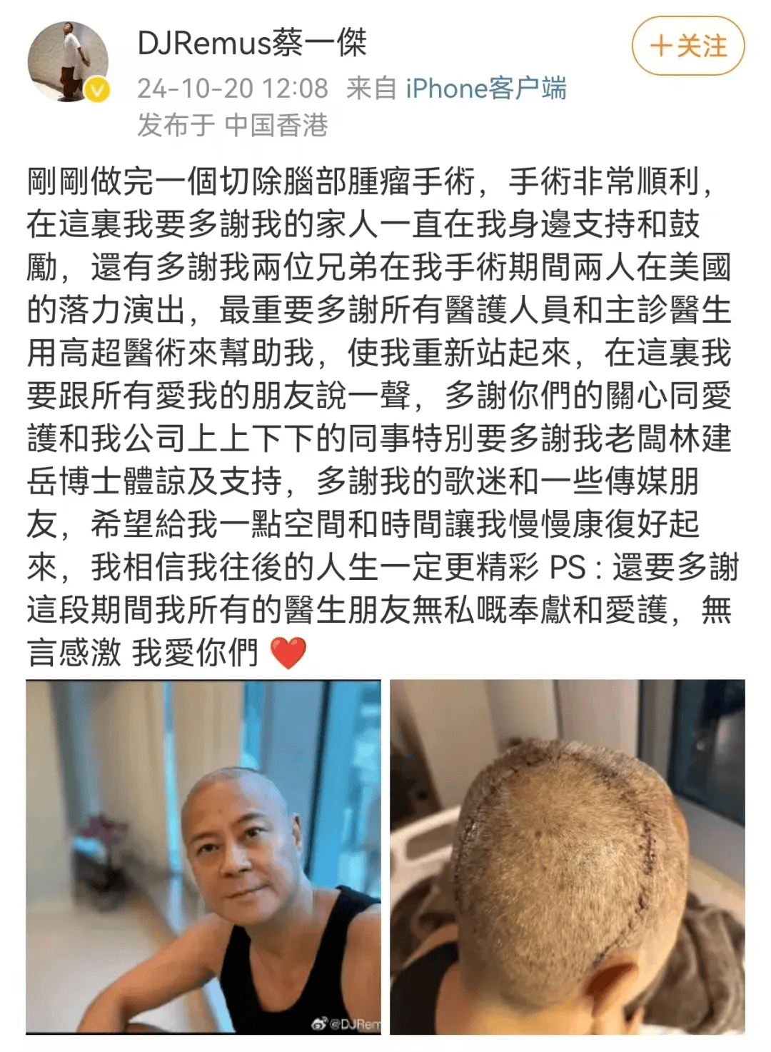 光头歌手王岚简历图片