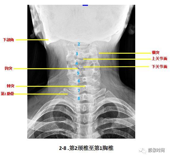 颈椎正位解剖颈椎侧位解剖颈椎张口位解剖1第一步