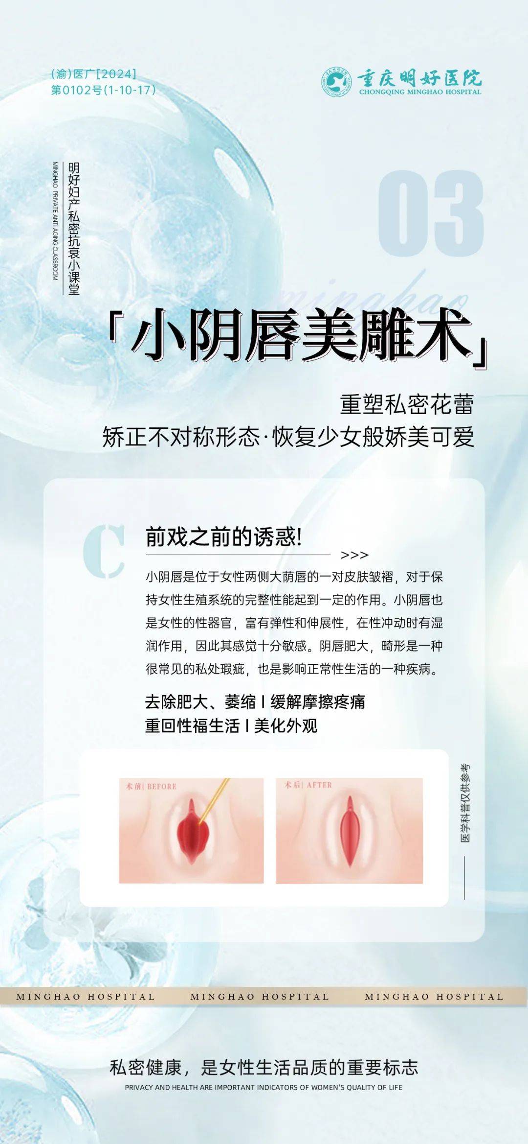 小阴唇 
