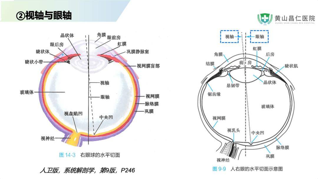 视神经颅内段图片